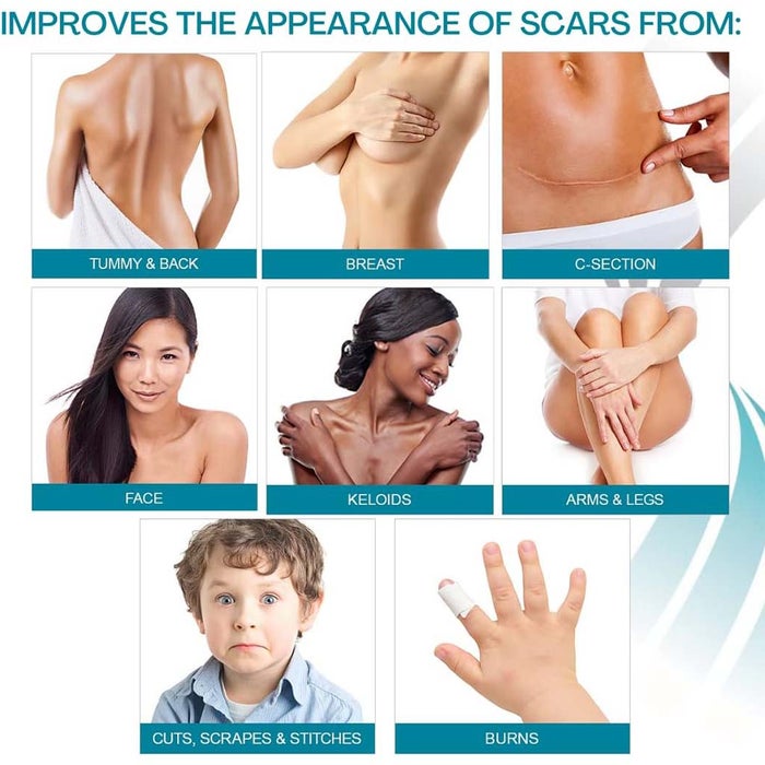 NewGel+E Advanced Medical-Grade Silicone Gel + Vitamin E for All Scar Types 15g Online | myAster UAE