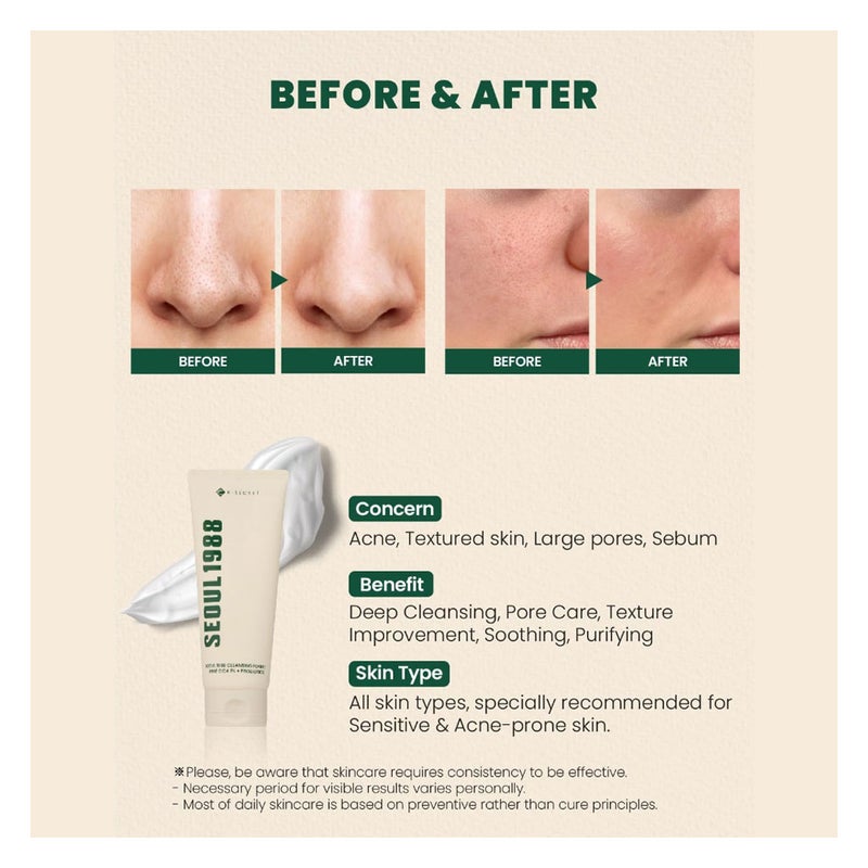 K-Secret Seoul 1988 Pine Cica 1% + Probiotics Cleansing Foam 150ml K-Secret