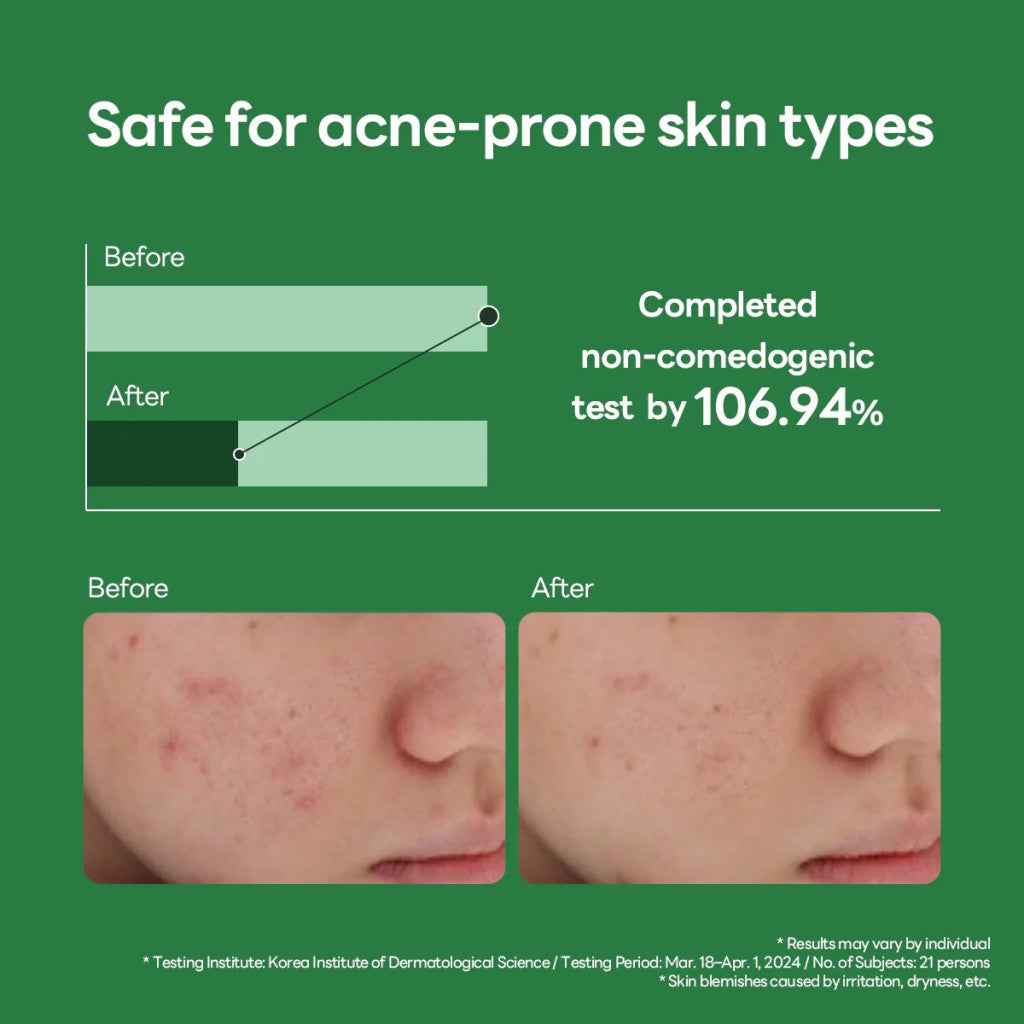 Mediheal Teatree Calming Hydra, Refreshing, Lightweight Hydrating Serum - 40ml