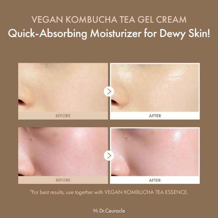 Dr. ceuracle vegan kombucha tea gel cream probiotic hydrating detox moisturizer 75g
