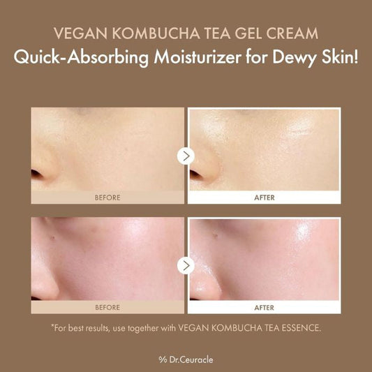 Dr. Ceuracle Vegan Kombucha Tea Gel Cream Probiotic Hydrating Detox Moisturizer 75g Dr. Ceuracle