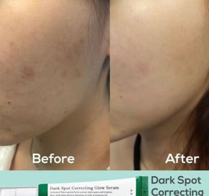 Axis-Y Dark Spot Correcting Brighten + Moisturize Glow Facial Serum 50ml