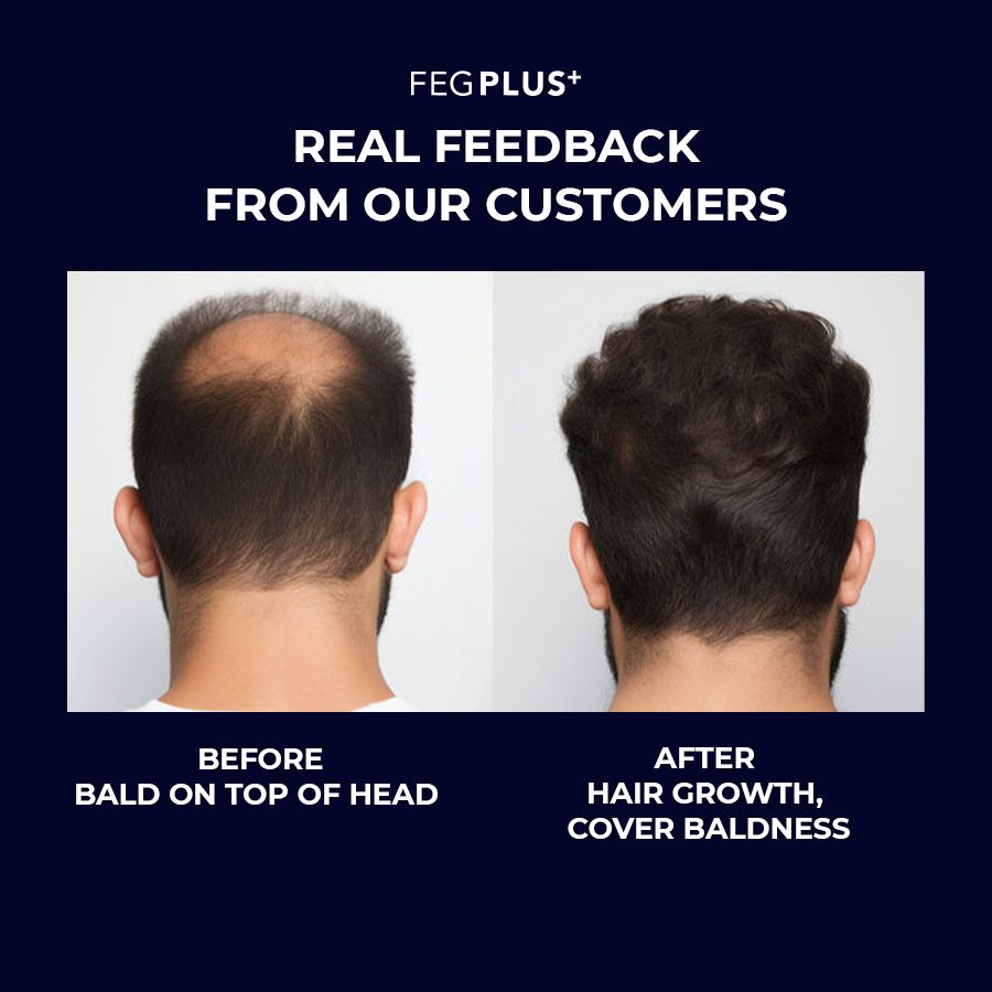 FEG Plus Hair Growth Serum + Hair Roller