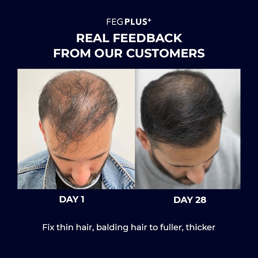 FEG Plus Hair Growth Serum + Hair Roller