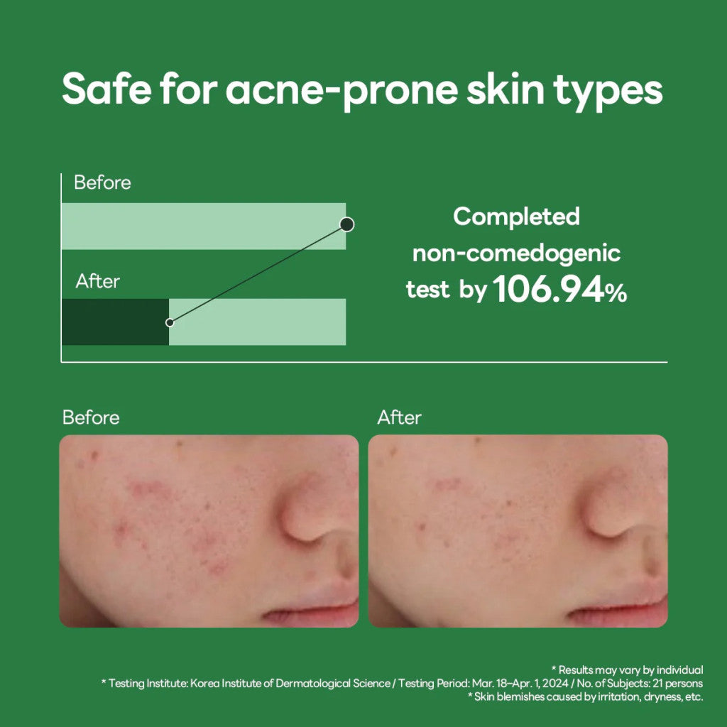 Mediheal Teatree Calming Hydra, Refreshing, Lightweight Hydrating Serum - 40ml Mediheal