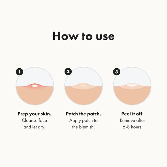 Mighty Patch Original – Hydrocolloid Acne Patches (36ct)