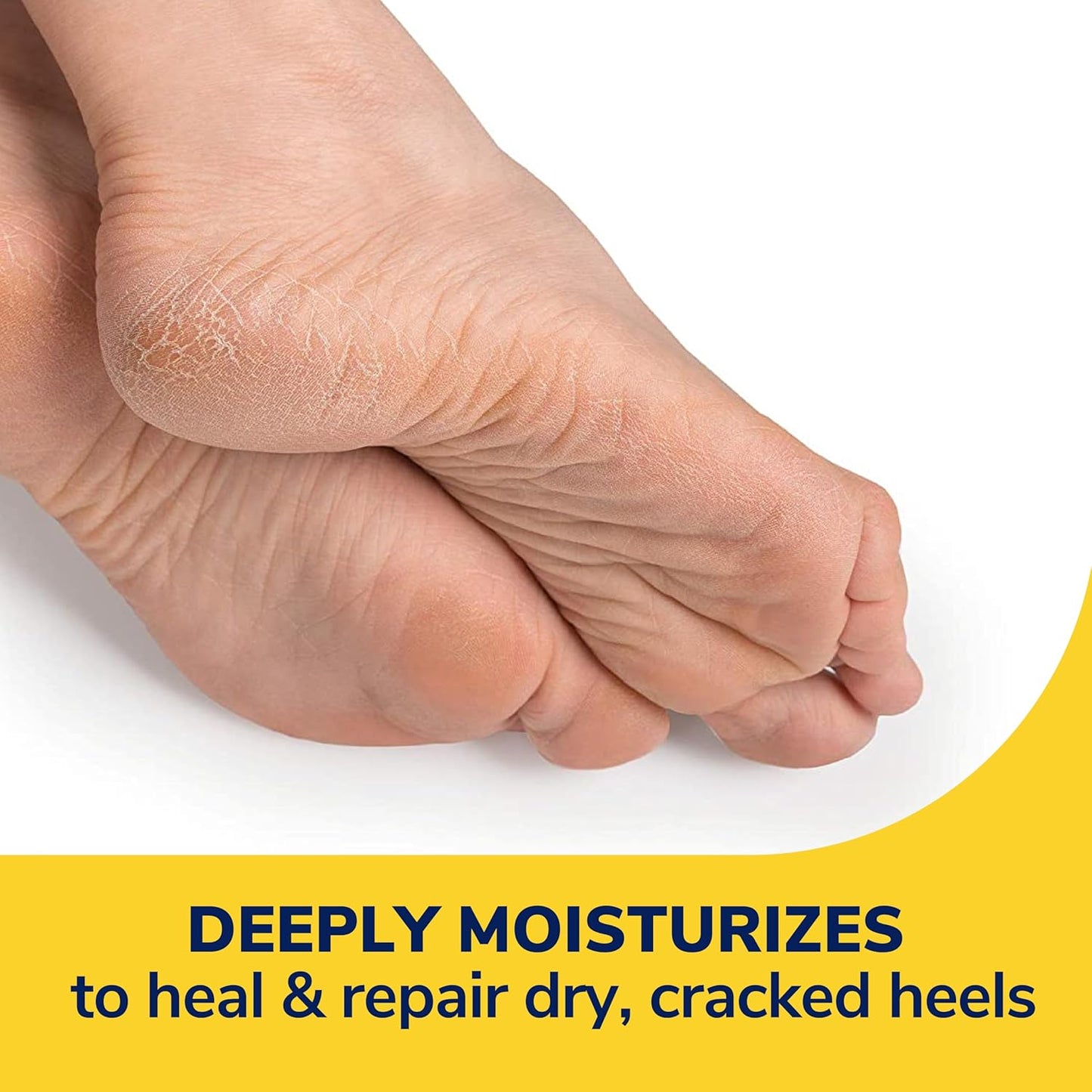 Dr. Scholl's Cracked Heel Repair Balm - 2.5oz Dr. Scholl's
