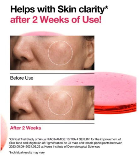 Anua Niacinamide 10% + Txa 4% Serum - 30Ml Anua