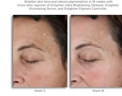 Neostrata Enlighten Pigment Controller Fluid For Dark spots and Uneven skin tone 50ml Neostrata