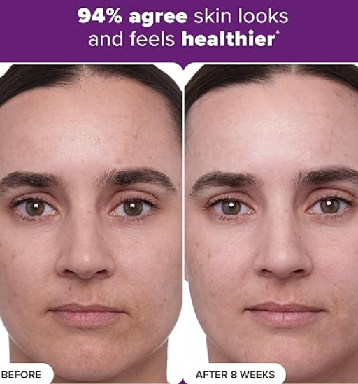 PAULA'S CHOICE (30ml) - CLINICAL 1% Retinol Treatment Cream Peptides, Vitamin C & Licorice Extract Anti-Ageing & Wrinkles 30ml paula s choice
