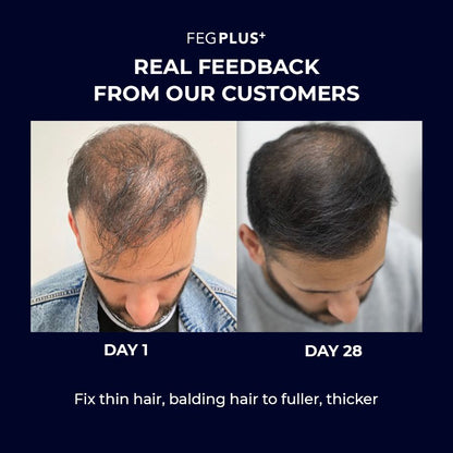 FEG Plus Hair Growth Serum +  Hair Roller